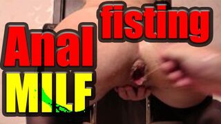 Du kan titta på en smutsig, anal milf knyter sig gratis